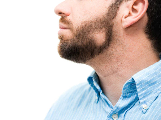 How to fix a patchy beard