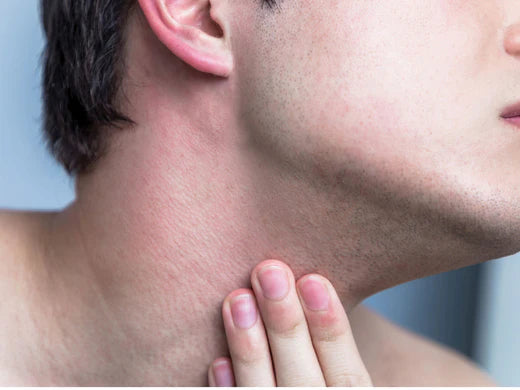 How to get rid of and prevent razor burn